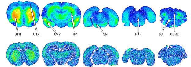 textbook:nrctextbook:autoradiogram_rat_brain_fig_13_10.png
